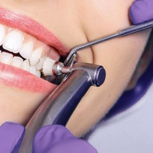 Профессиональная гигиена и чистка зубов