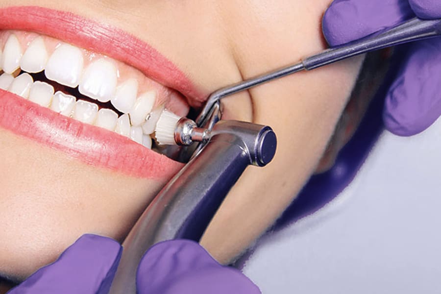 Профессиональная гигиена и чистка зубов